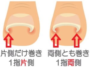 ���i�C���[�W